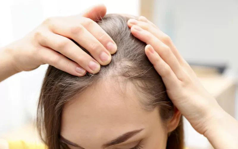 Haarausfall & Dünnes Haar